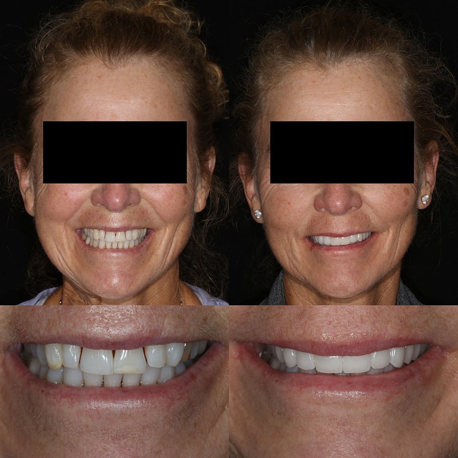 Before and after dental transformation images.