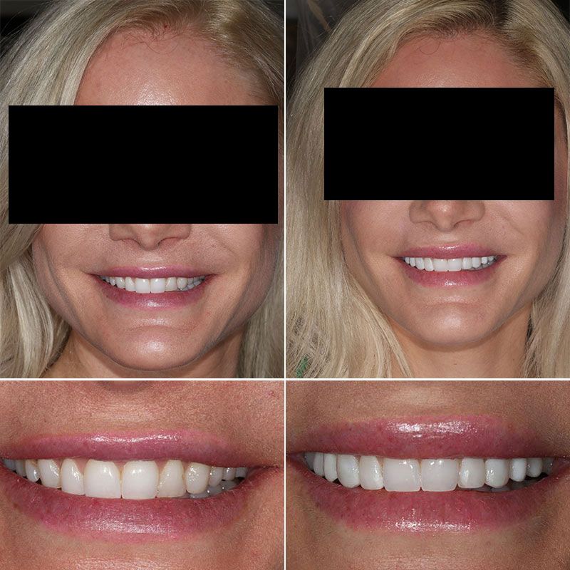 before and after images