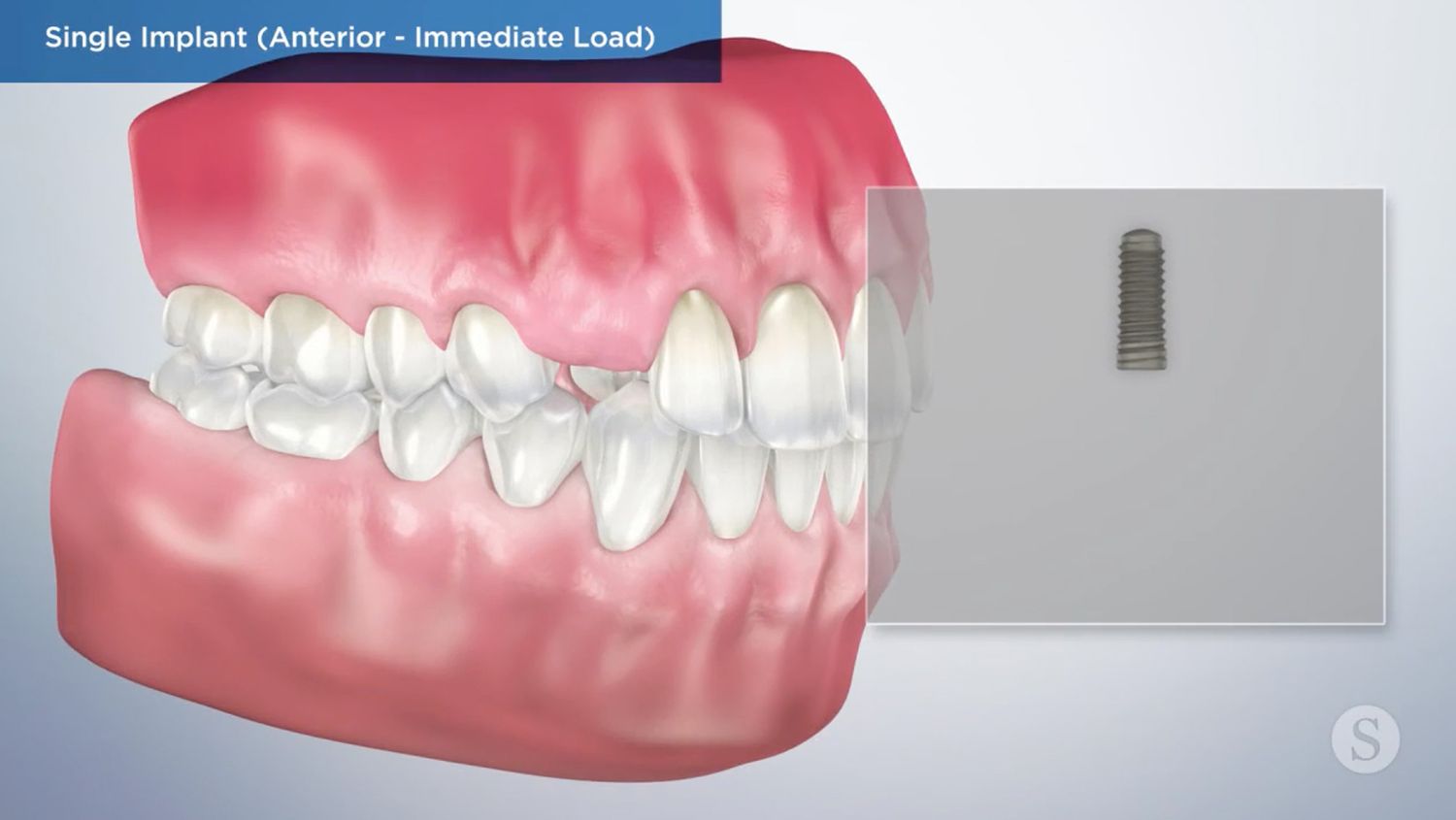 teeth model