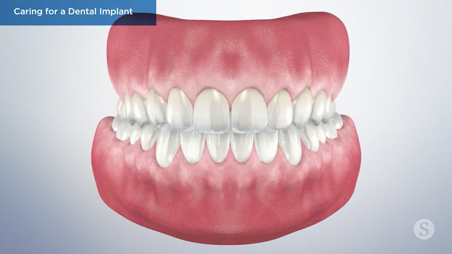 teeth model