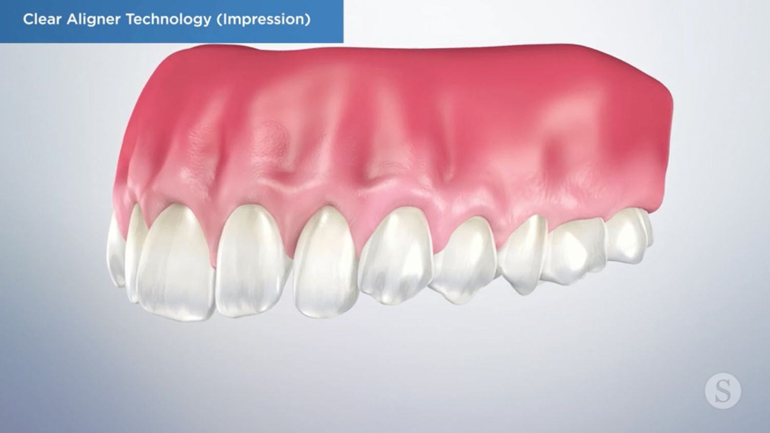teeth model